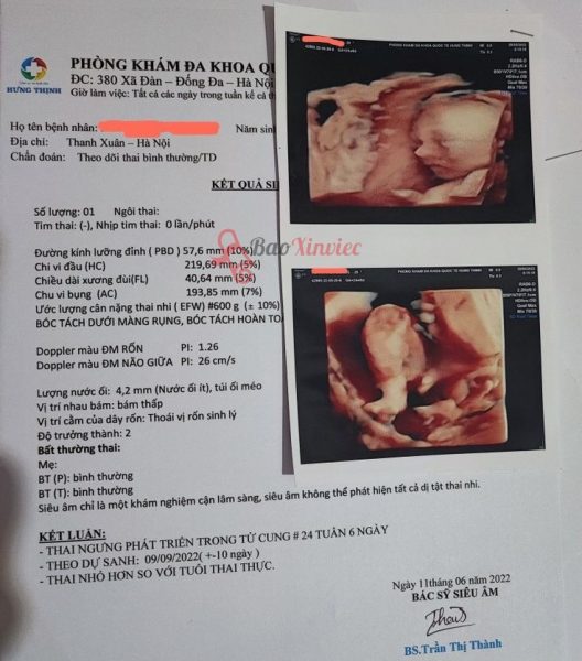 Làm Giấy Khám Thai Giả Không Cần Đến Bệnh Viện